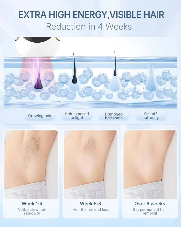 Avrelle Glow Pro IPL™