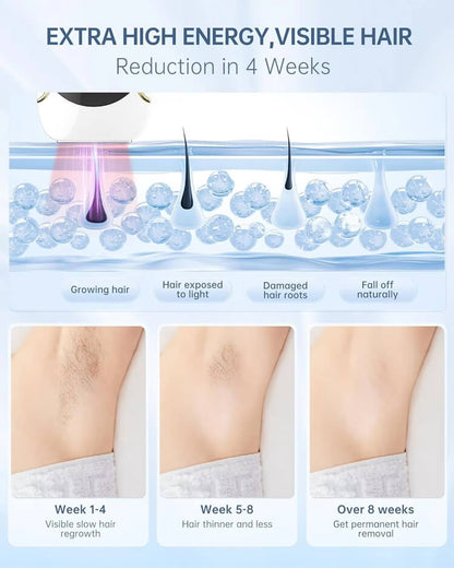 Avrelle Glow Pro IPL™